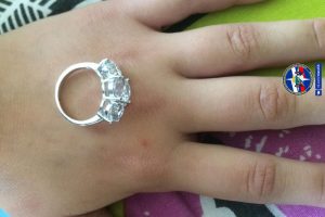 Спасатели МАСС сняли кольцо с отёкшего пальца девочки-подростка‍