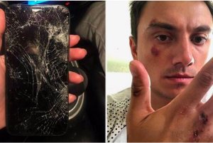 В Новосибирске таксист избил клиента и разбил его телефон