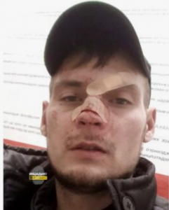 В Новосибирске охранник «Ашана» сломал нос мужчине