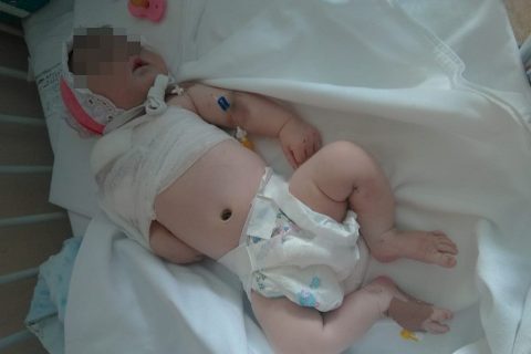Новорожденную девочку с переломом руки спасают в областной больнице Новосибирска