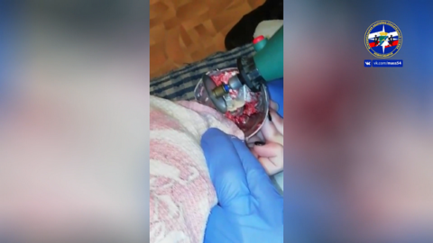 У жительницы Новосибирска в блендере застрял палец