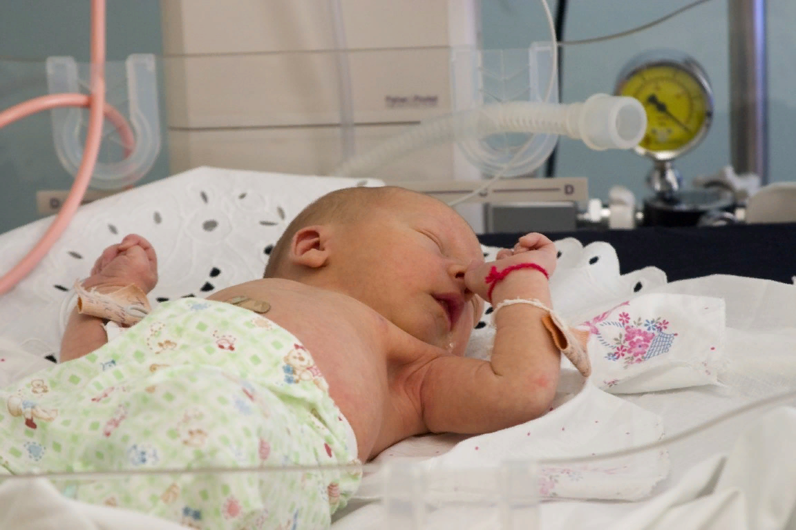 Асфиксия новорожденных. Новорожденные дети. Новорожденный в больнице. Новорождённые дети в больнице.